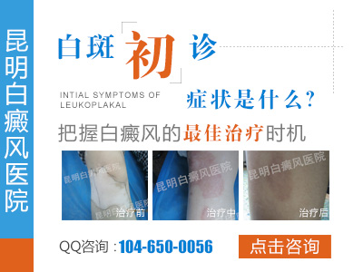 寻常型白癜风有哪些要注意的事项？