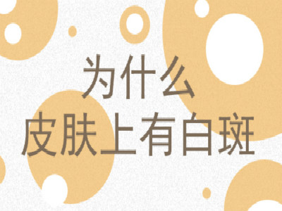 云南如何确定白癜风病因