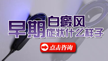 昆明白癜风医院专科：手臂白癜风有哪些特点